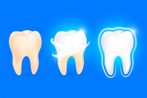 Esthetic Dentistry Considers The Natural And Individual Color Of Teeth