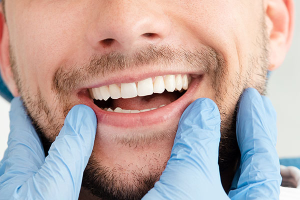 Esthetic Dentistry Looks at the Harmony and Balance of Teeth, Facial Features and Gums from Barry Jones DDS in Vista, CA