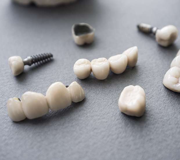 Vista The Difference Between Dental Implants and Mini Dental Implants