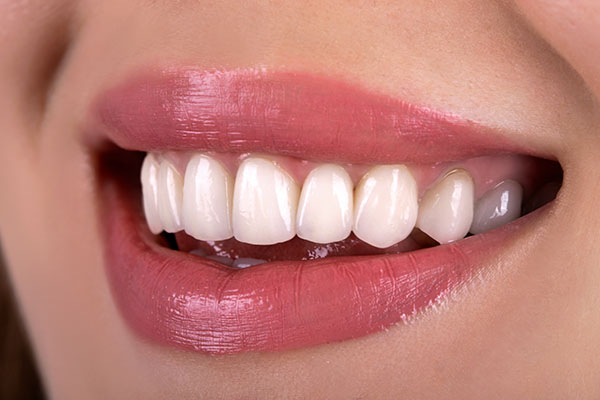 Non Invasive Esthetic Dentistry Cavity Treatment
